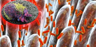 A high-fiber diet improve gut microbiota and the response of melanoma patients to immunotherapy