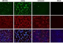 Omicron Has Shifted To Using Cathepsins For Cell Entry Via Endosomal Fusion