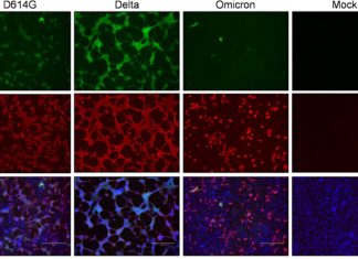 Omicron Has Shifted To Using Cathepsins For Cell Entry Via Endosomal Fusion