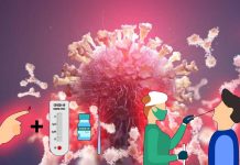 Diagnostic Testing In COVID-19