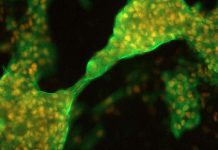 Human pluripotent stem cell-derived cardiomyocytes (hPSC-CMs) are susceptible to SARS-CoV-2 infection
