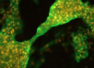 Human pluripotent stem cell-derived cardiomyocytes (hPSC-CMs) are susceptible to SARS-CoV-2 infection