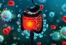 ApoA-I Mimetic Peptides Derived From Tomato Extract Can Reduce Intestinal Inflammation Due To HIV