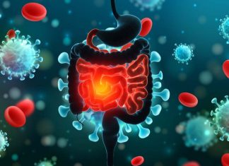 ApoA-I Mimetic Peptides Derived From Tomato Extract Can Reduce Intestinal Inflammation Due To HIV