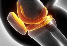 Regrowing knee cartilage with nanofibers of poly-L lactic acid (PLLA)