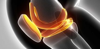 Regrowing knee cartilage with nanofibers of poly-L lactic acid (PLLA)