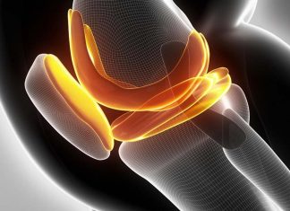 Regrowing knee cartilage with nanofibers of poly-L lactic acid (PLLA)