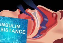 Sleep-disordered breathing in early pregnancy is associated with insulin resistance