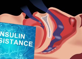 Sleep-disordered breathing in early pregnancy is associated with insulin resistance