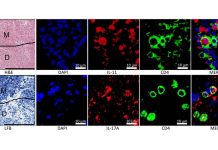 Th17 cells are responsible for promoting autoimmune diseases such as multiple sclerosis
