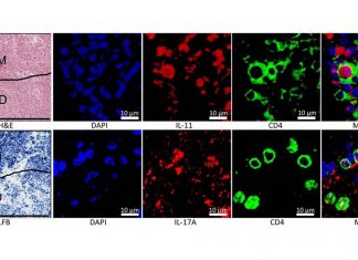 Th17 cells are responsible for promoting autoimmune diseases such as multiple sclerosis