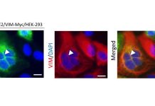 Vascular Protein Vimentin Assists SARS-CoV-2 Access Into Cells and Contributes To Vascular Complications