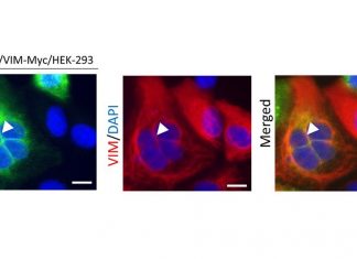Vascular Protein Vimentin Assists SARS-CoV-2 Access Into Cells and Contributes To Vascular Complications
