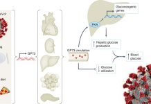 SARS-CoV-2 Infection Induces Increase Of GP73 That Causes Dysglycaemia