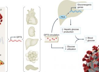 SARS-CoV-2 Infection Induces Increase Of GP73 That Causes Dysglycaemia