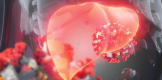 Understanding the Connection Between Metabolic Dysfunction-Associated Steatotic Liver Disease (MASLD) and Increased Susceptibility to SARS-CoV-2 Infection