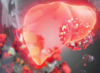 Understanding the Connection Between Metabolic Dysfunction-Associated Steatotic Liver Disease (MASLD) and Increased Susceptibility to SARS-CoV-2 Infection