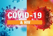 Uncovered the Similarities and Differences Between SARS-CoV-2 And HIV-1 Infections