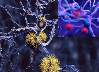 U.S Department Of Defense Study Finds That COVID-19 Infected Individuals Younger Than 60 Years Are Developing Beta-Amyloid Deposits