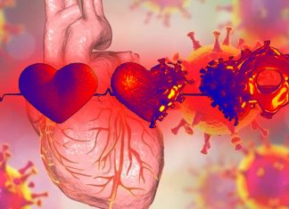 Heart Blocks Are Another Predominant Cardiovascular Occurrence In COVID-19 Patients Besides Myocarditis