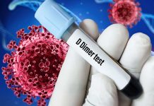 D-dimer levels can predict disease outcome in hospitalized patients with COVID-19