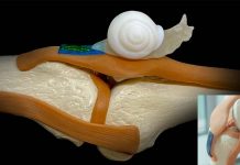 New biomaterial-based tendon therapy that addresses key challenges in the regeneration process