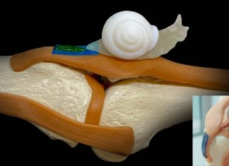 New biomaterial-based tendon therapy that addresses key challenges in the regeneration process