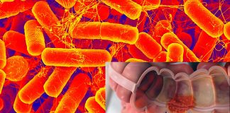 Researchers have identified a class of microbial enzymes originating from the gut resident Bacteroides vulgatus that drive ulcerative colitis