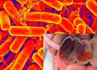 Researchers have identified a class of microbial enzymes originating from the gut resident Bacteroides vulgatus that drive ulcerative colitis