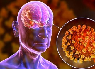 One-third of patients with COVID-19 develop neurological symptoms