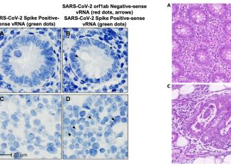 Long COVID-19: Persistence of residual SARS-CoV-2 viral antigen and RNA in tissues of patients