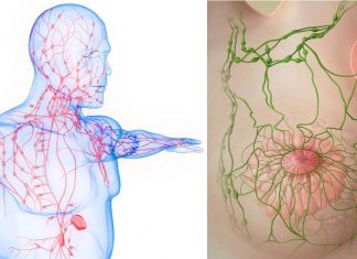 La linfoadenopatia post vaccinazione COVID-19 – con aumento dell’assorbimento di FDG – può essere erroneamente attribuita a disturbi oncologici