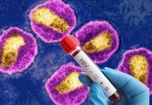 New Highly Virulent HIV Variant Discovered In Netherlands