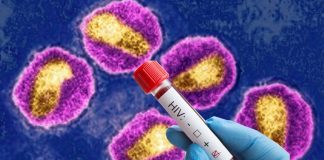 New Highly Virulent HIV Variant Discovered In Netherlands