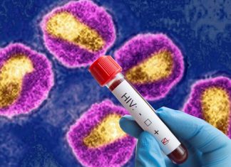 New Highly Virulent HIV Variant Discovered In Netherlands