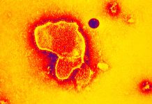 Azithromycin doesn’t prevent future wheezing in babies hospitalized with RSV