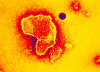 Azithromycin doesn’t prevent future wheezing in babies hospitalized with RSV