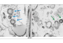 I ricercatori hanno scoperto che il tropismo testicolare SARS-CoV-2 è più alto di quanto si pensasse