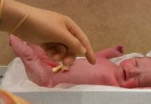 Being born to term with a weight lower than 3.5 kilos is related to a higher risk of developing neurodevelopmental problems