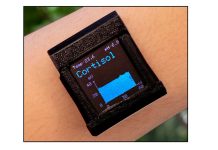 Newly developed smartwatch measures key stress hormone