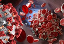 SARS-CoV-2 Induced Antiphospholipid Antibodies Causes Endothelial Cell Activation And Dysfunction Leading To Severe Covid-19 Clotting