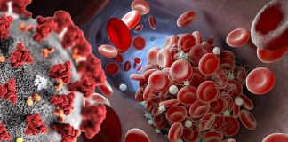 SARS-CoV-2 Induced Antiphospholipid Antibodies Causes Endothelial Cell Activation And Dysfunction Leading To Severe Covid-19 Clotting