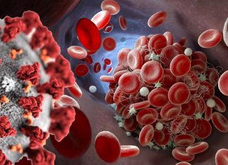 SARS-CoV-2 Induced Antiphospholipid Antibodies Causes Endothelial Cell Activation And Dysfunction Leading To Severe Covid-19 Clotting