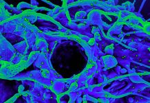 Denmark Reports: New BA.2 Sub-Lineage With H78Y Mutation in ORF3a