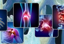 Only high levels of activity at least once a week appears to help ward off chronic musculoskeletal pain in the long-term