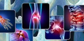 Only high levels of activity at least once a week appears to help ward off chronic musculoskeletal pain in the long-term