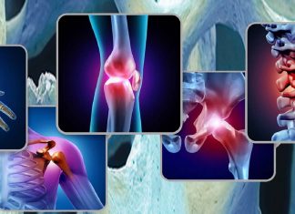 Only high levels of activity at least once a week appears to help ward off chronic musculoskeletal pain in the long-term