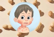 Two new treatments can induce peanut allergy remission in children