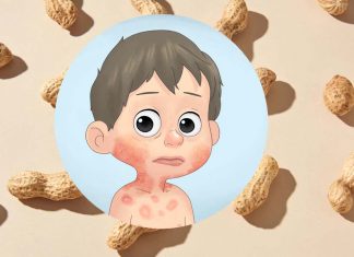 Two new treatments can induce peanut allergy remission in children