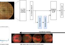 Researchers have developed a self-learning software able to identify vascular changes in patients with peripheral arterial disease (PAD)